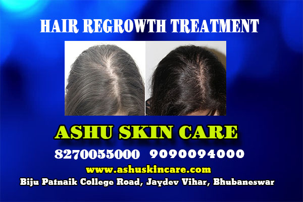 best hair regrowth treatment clinic in bhubaneswar near hitech hospital